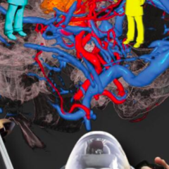 Surgical Theater Presents AR Experience for Neurosurgery